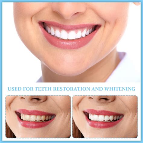 Achieve the Smile of Your Dreams with Magic Smile Veneers
